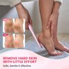 BEZOX Long Handle Glass Foot File Callus Remover, Foot Scrubber for Dead Skin, Cracked Heel Foot Scraper - Purple