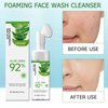 Aloe Vera Face Wash for Dry Sensitive Skin, Foaming Facial Cleanser, Amino Acid Gentle Face Cleanser, Hydrating Foaming Face Wash for Sensitive Skin, Moisturizing Facial Cleansing Washes for Acne Skin