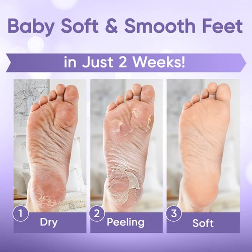 Foot Peel Mask (2 Pairs) - for Baby Soft Skin Remove Dead Skin, Dry, Cracked Feet & Callus, Spa, Made with Aloe Vera Extract Women and Men Peeling Exfoliating, Lavender