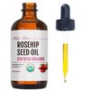 Kate Blanc Cosmetics Rosehip Oil for Face & Skin (1oz, Organic, Pure, Cold Pressed) Rosehip Seed Face Oil for Facial & Gua Sha Massage