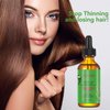 Rosemary Hair Growth Oil and Serum - Dry Scalp Treatment, Hair Thickening Products for Women, Hair Loss Essential Oils for Diffuser (2OZ)