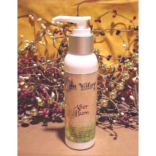 After Burn Sun and Burn Cream 4.0 oz