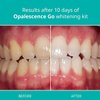 Opalescence Go 10- Prefilled Teeth Whitening Trays Kit- 10% Hydrogen Peroxide - (10 Treatments) - Mint Made by Ultradent Products. Go Teeth Whitening Kit -Mint- GO10-5193-1