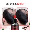 KUNDAL Cherry Blossom CAFFEINE ANTI-HAIR LOSS SHAMPOO Scalp Care Deep Cleansing 10.14 Fl Oz