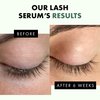 𝗧𝗢𝗣 𝟮𝟬𝟮𝟯* Lash Serum - Eyebrow + Eyelash Serum with Vitamin B5, Safe for Eyes Brow & Lash Growth Serum, Premium Serum to Grow Lashes + Brows, Perfect Long Lash Serum, Natural Look, Gentle + Safe
