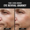 Superior Mane Eye Repair Stick for Men | UnderEye Serum Roller for Dark Circles w/Caffeine, Vitamin B3 Peptides & Ceramides | Reduces Puffiness Dark Circles | Anti-Aging Eye Stick for Bags under Eyes