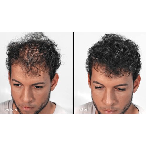 MAXX PRO-SERIES Volumizing Hair Fibers with real Keratin for Thinning Hair/Hair Loss – Dermatologist Tested and Certified Hypoallergenic - 60 days + supply - Multiple Colors Available (Medium Brown)