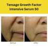 Generic BiopelleBrand Tensage Growth Factor Intensive Serum 50, 10 Count(1.5ml) 0.05oz, Facial Serum with SCA 50 Biorepair Index