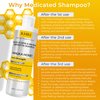 Antifungal Psoriasis Shampoo, Eczema, Shampoo, Seborrheic Dermatitis Shampoo | Soothes Itching, Flaking & Irritation | Repairs Scalp, Strengthens Hair, Stimulates Regrowth | Medicated Scalp Treatment