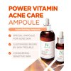 AMPLE:N VC Shot Serum - Anti-Aging Face Serum with Vitamin C – Evens Pigmentation and Aging Spots - Vitamin C Serum to Clear Skin of Sun Damage and Reduce Wrinkles, 3.38 fl.oz.