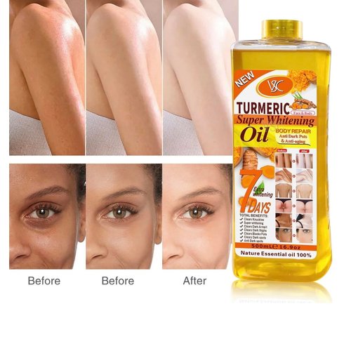 Turmeric Oil Super Whitening Face & Body Moisturizer Nourishing Anti-aging Correct Spots Wrinkle Skincare Essential oil 500ML/16.5oz