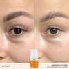 REN Clean Skincare Radiance Brightening Dark Circle Eye Cream - Lightweight & Hydrating, Helps to Even Skin Tone, Lifts & Improves the Appearance of Firmness, Suitable for Sensitive Skin