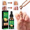 2PCS Ginger Nail Treatment, 7 Days Ginger Nail Treatment, Nail Oil Serum Ginger Nail Growth Oil