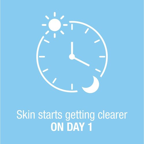 Neutrogena On-the-Spot Acne Treatment, Vanishing Formula 0.75 oz (Pack of 4)