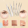 Blackhead Remover Pimple Popper Tool Kit, 6-in-1 Blackhead Comedone Acne Blemish Pimple Extractor Tool Kit Tweezers Kit Skin Care Tools for Face