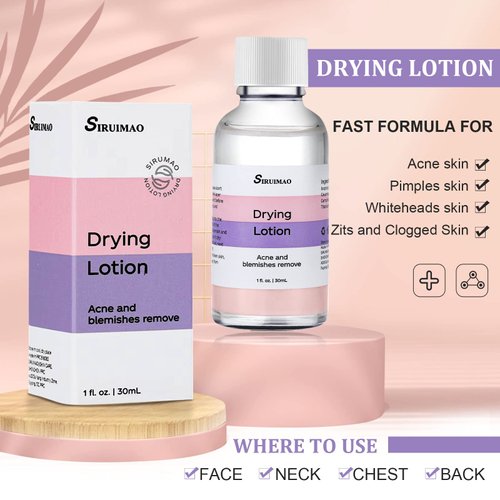 SIRUIMAO Stubborn Acne Drying Lotion (1OZ), Overnight Acne Acid and Acne Spot Treatment for Face and Body, Pimple Lotion Spot Treatment, Dry Out Pimples, Blemishes, Zits and Clean pores (1PCS)