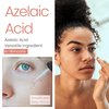 Azelaic Acid Powder (1 Oz / 28 gram) 99.9% Azelaic Acid Fine Powder for Making DIY Azelaic Acid Cream, Gel and Azelaic Acid Serum by Talsen Chemicals