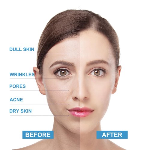 Face Scrub Blueberry Facial Scrub Facial Exfoliator Facial Peeling Brightening Exfoliating Face Wash Cleanser For Dull Skin Blackheads Acne vitamin c scrub exfoliator scrub for Women Men