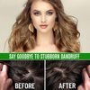 ALIVER Batana Oil for Hair Growth, Batana Oil Organic Cold Press, 100% Natural Batana Hair Oil - Enhances Hair & Skin Radiance, Anti Hair Loss and Repair Damaged Hair, 2.02 Fl Oz