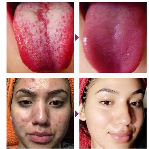 Foot Pads 100 Pieces Foot Patches Deep Cleansing Foot Pads Bamboo Vinegar Foot Pads Ginger Foot Pads