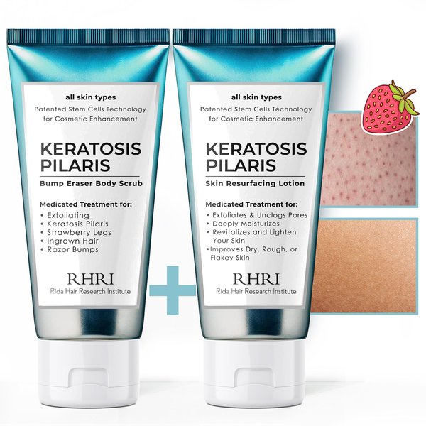 KP Bump Eraser Body Scrub + Keratosis Pilaris Lotion Bundle Set, Strawberry Legs Treatment for Women, Bump Eraser Body Scrub, Keratosis Pilaris, Body Scrub for Strawberry Legs