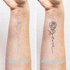 5X2Y Tattoo Tech, Long Lasting Temporary Tattoos, Last 1-2 Weeks, Waterproof, Semi Permanent Tattoo, Realistic look, No Adhesive, No reflection (Dragonfly)