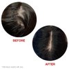 HAIRtamin Scalp Serum Natural Hair Growth Thickening Treatment | Visibly Increases Thicker Looking Hair and Promotes Scalp Health | Nourishes & Hydrates Dry, Itchy Scalp