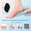 Glass Foot File Callus Remover - Foot Scrubber and Heel Scraper for Dead Skin Removal, Foot Buffer Pedicure Tool, Perfect for Men and Women, Get Soft, Smooth Foot (Blue)