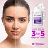 Le Pommiere Anti Acne Treatment Cream, Remove Pimples on Face and Body. Teenager, youth, adult, hormonal or cystic