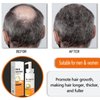 Hotiary Rice Water Shampoo for Hair Loss, Hair Regrowth Shampoo Nourishing and Repair Damage Hair Thining Balding Hair Treatment