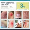 Ceeport Xeroform Petrolatum Dressing 4x4, Non-Adherent Medical Gauze Pad Strip, Soft Fine Mesh Gauze Patch for Wound Care, Burns, Lacerations, Skin Grafts & Surgical Incisions (25 Individual Pack)