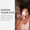 i-Chek by Avenova – An Illuminated, Magnifying Eyelid & Eyelash Mirror for Blepharitis, Chalazion, Styes, Dry Eyes, Contact Lenses, and Lash Extensions