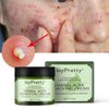 Acne Treatment Face Cream,Acne Spot Treatment for Face & Acne Dots,Natural Herbal Ingredients Professionally Remove Acne Marks,For Teens & Adults Anti-acne Moisturizer Pimple Cream