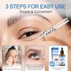 Stye Eye Treatment, Eye Stye Remover Drops, Gentle Relief for Chalazions, Blepharitis, Eyelid Bumps, Natural & Non-Irritating, Fast Acting Soothing, 30ml