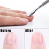 8 Pack Cuticle Pusher Set Stainless Steel Cuticle Remover Kit Professional Nail Polish Remover Nail Art Care Tools for Women and Girls Fingernail and Toenails (4 Pcs/Set)