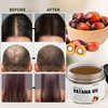 Batana Oil for Hair Growth,100% Raw Batana Oil Prevent Hair Loss,Organic Dr. Sebi Batana Oil from Honduras Repair Splitting, Drying and Injuring Hair, Natural Hair Oil for Thicker Fuller Hair-5.3 OZ