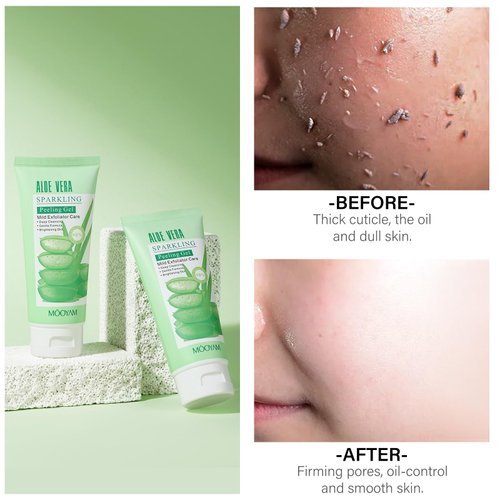 Peeling Gel Aloe Vera Sparkling Peeling Gel, Deep Cleansing Face Scrub Exfoliating Face Wash Brightening Facial Scrub Facial Exfoliator Exfoliant Facial Dead Skin Remover for Face Acne Dark Spots