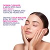 GlamyFace New Salicylic Acid Cleanser, Face Cleanser, Acne Treatment, Anti Aging