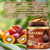 Batana Oil for Hair Growth,Organic Raw Batana Oil Hair Mask & Ginger Hair Growth Oil,Hair Oil Hair Treatment for Frizzy Damaged Hair,For Thicker-Strong Hair,Nourishes Scalp,Repair Dry Damaged Hair