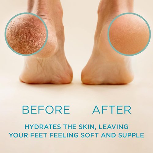 Lee Beauty Professional Callus Remover for Feet - Original, Powerful Formulation - Extra Strength Gel, Home Pedicure Foot Spa Results - Cracked & Dead Dry Skin Supplies - 8 Oz