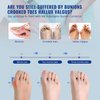 Fit Geno Bunion Corrector Women & Men Big Toe: Foot Straightener Splint Brace - Adjustable Bunyan Correction Orthopedic for Hallux Valgus Pain Relief 2 Pcs