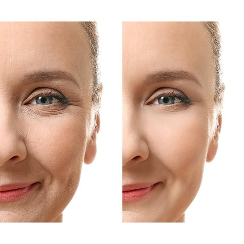 Adama Minerals Wrinkle Erase Acid Cream. Fast Action Night Cream.