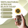 Raw African Black Soap Bar – Black African Soap for oily Skin, Scars, Dark Spots | Perfect for Pimples, Blackhead, Face & Body Wash | Face and Body Wash Soap 1 Count