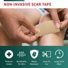 Medical-Grade Silicone Scar Tape Roll (1.6" x 118") Silicone Scar Sheets Keloid Bump Removal - Reusable Silicone Tape Scar Removal Strips, Scar Tape for Surgical Scars, C Section Scar Silicone Strips