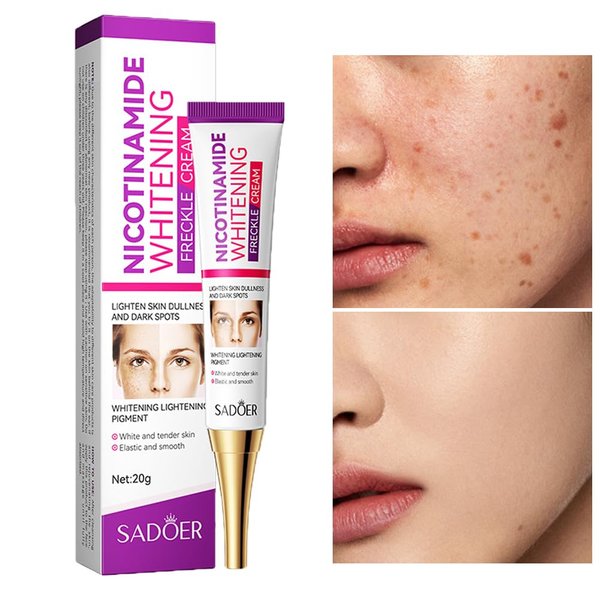 paminify Dark Spot Remover for Face,Nicotinamide Whitening Freckle Cream,Skin Dullness Lightening Body Cream,Visible Results in 28 Days,Smooth Melasma,Hyperpigmentation Age Dark Spot Corrector,0.7 oz