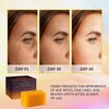 Valitic 2 Pack Kojic Acid Dark Spot Corrector Soap Bars with Vitamin C, Retinol, Collagen, Turmeric - Original Japanese Complex with Hyaluronic Acid & A Pair of Black Exfoliating Gloves for Body Scrub