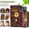 Hair Growth Shampoo, Hair Loss Shampoo, Hair Thickening Shampoo, Anti-Thinning Shampoo, Hair Growth-Thickening Shampoo, Hair Loss Treatment, for Stop Hair Loss, Grow Hair Fast, Men & Women, 220ML