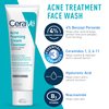 CeraVe Acne Skin Care Set | 5oz Acne Foaming Cream Cleanser + 1oz Resurfacing Retinol Serum + 2oz AM Facial Moisturizing Lotion with SPF 30 + 2oz PM Facial Moisturizing Lotion | Skin Care Routine