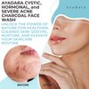 AYADARA Severe Acne Charcoal Face Wash, 3.4 oz, Daily Face Wash with Sulfur and Honey, Charcoal Face Cleanser, Mens Face Wash for Acne, Deep Cleansing Charcoal Face Wash for Women and Men, 200 Uses