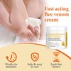 Zealand Bee Venom Professional Serum Treat, Joint & Muscle & Bone Gel - Easy to Use Fast Acting Soothing Effective Help for Back, Neck, Hand, Foot, Knee, Muscle, Shoulder, Hip, Nerves